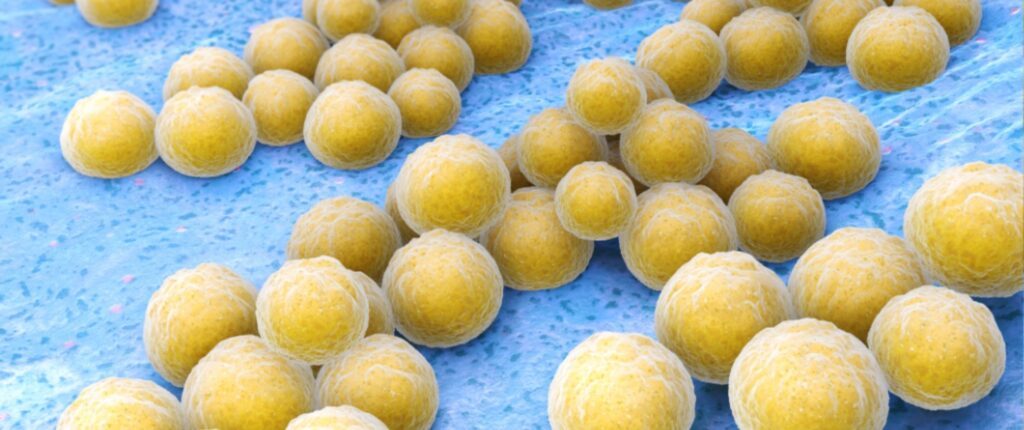 MRSA